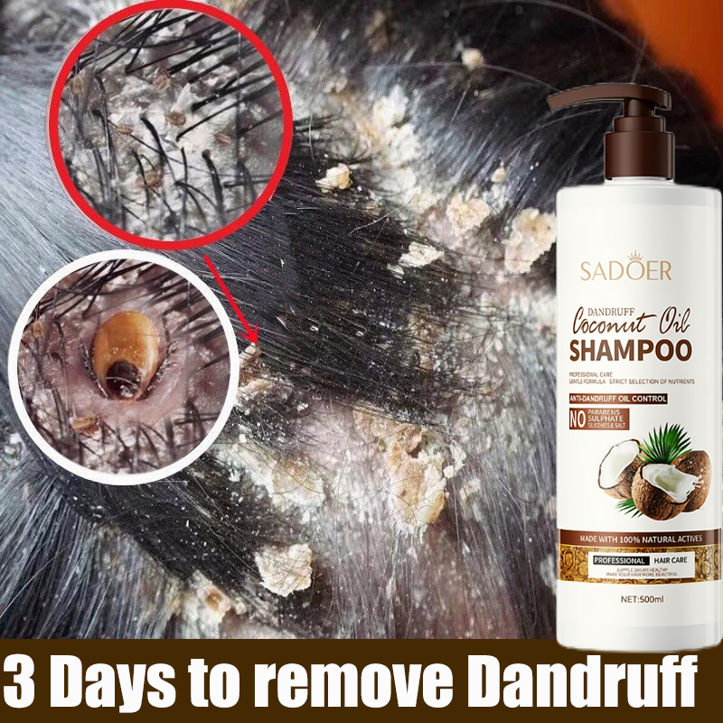 shampo anti ketombe Sampo Anti Ketombe Shampo Kelapa Pelembab anti gatal Coconut shampo kutu rambut 