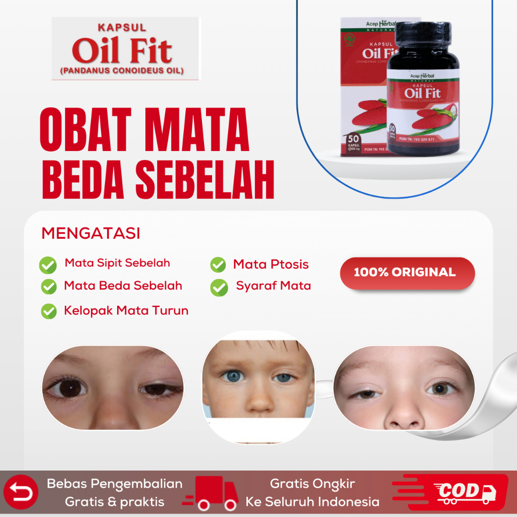 Obat Mata Ptosis, Mata Beda Sebelah, Mata Sipit Sebelah, Kelopak Mata Turun, Mata Kecil Sebelah, Mat