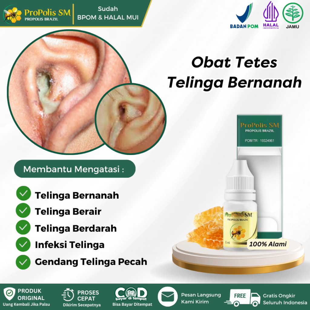 Obat Telinga Bernanah, Telinga Berair, Telinga Congek, Telinga Berdarah, Telinga Bau Berair, Telinga