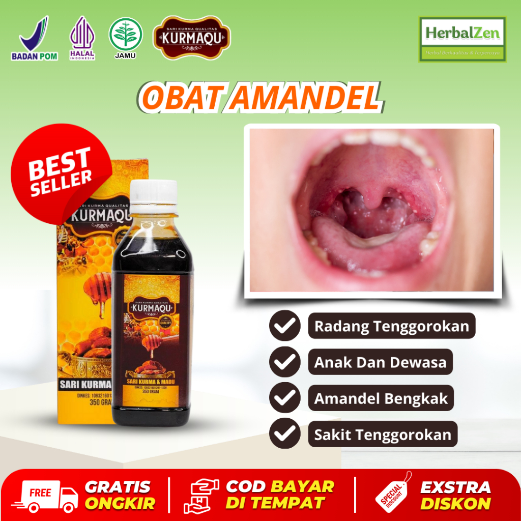 Obat Amandel Radang Tenggorokan Anak dan Dewasa Amandel Bengkak Sakit Tenggorokan Kurmaqu