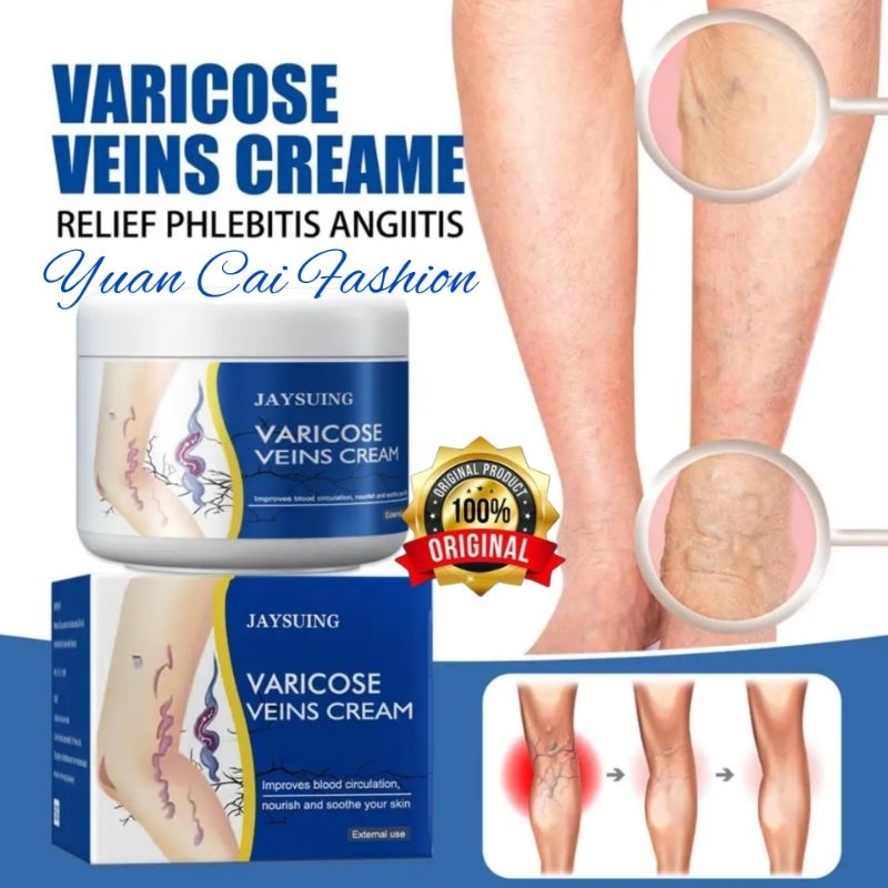 JAYSUING, 50G Krim Varises, EXP : 2027 Krim Kaki Menenangkan Varises Vena Alami Pengobatan Varises &