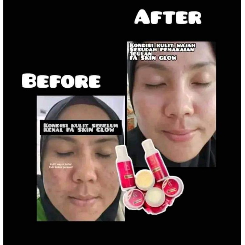 FA glow skincare