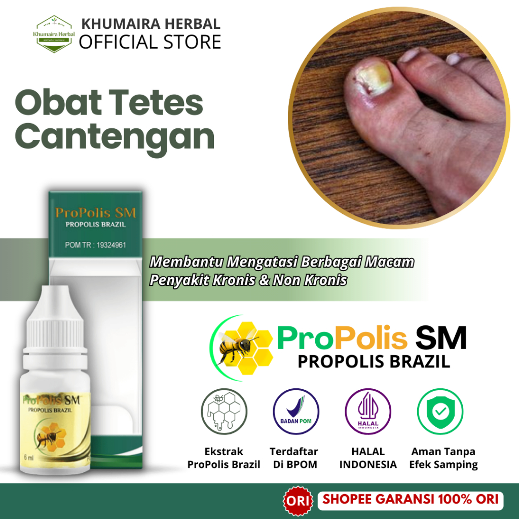 Obat Cantengan Jempol Kaki, Obat Kuku Rusak, Kaki Bengkak Bernanah, Obat Kuku Bau, Kuku Berjamur, In