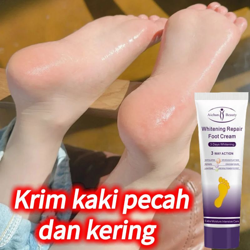 Krim kaki pecah dan kering Tumitku obat kaki pecah Salep kaki pecah dan kering ampuh Pelembab kaki p