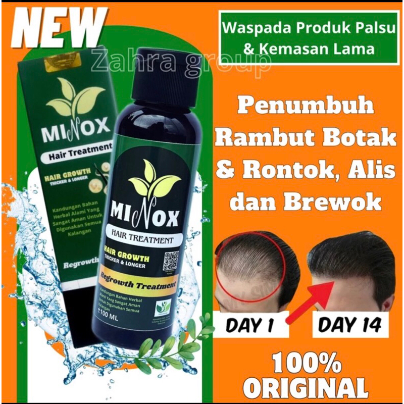 VIRAL [MINOX] Penumbuh Rambut Botak Depan, Tipis, Rontok & Brewok Sangat Cepat dan Ampuh isi 100 ML
