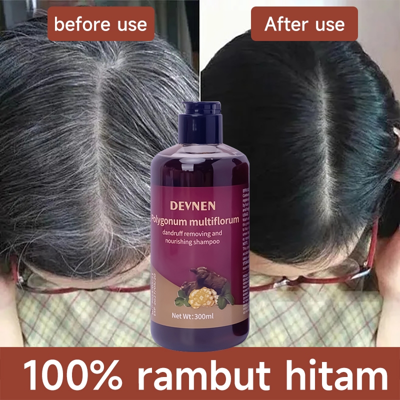 300ML Natural Polygonum Shampoo perawatan rambut anti uban penghilang uban permanen di usia muda pen