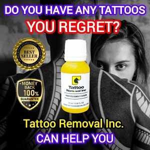 Penghilang Tato: Tattoo Removal Inc Paling Ampuh Untuk Hapus Tinta Tato Permanen