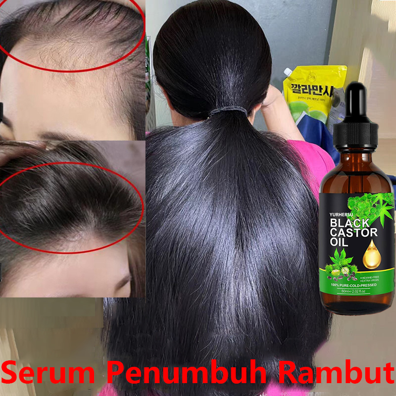 Serum Penumbuh Rambut Cepat Hair Growth Serum Penumbuh Rambut Botak Obat Penumbuh Rambut Botak Penum