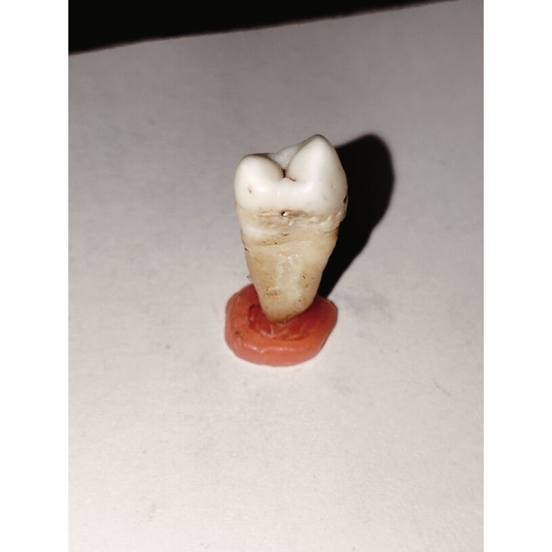 Gigi asli premolar 15