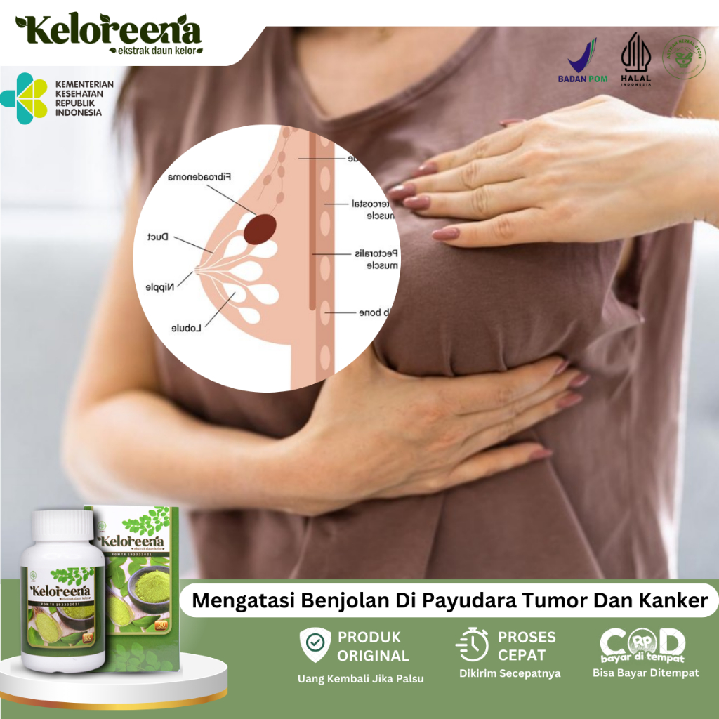 Obat Nyeri Payudara, Obat Benjolan Di Payudara, Obat Sakit Payudara, Obat Payudara Bengkak, Obat Abs