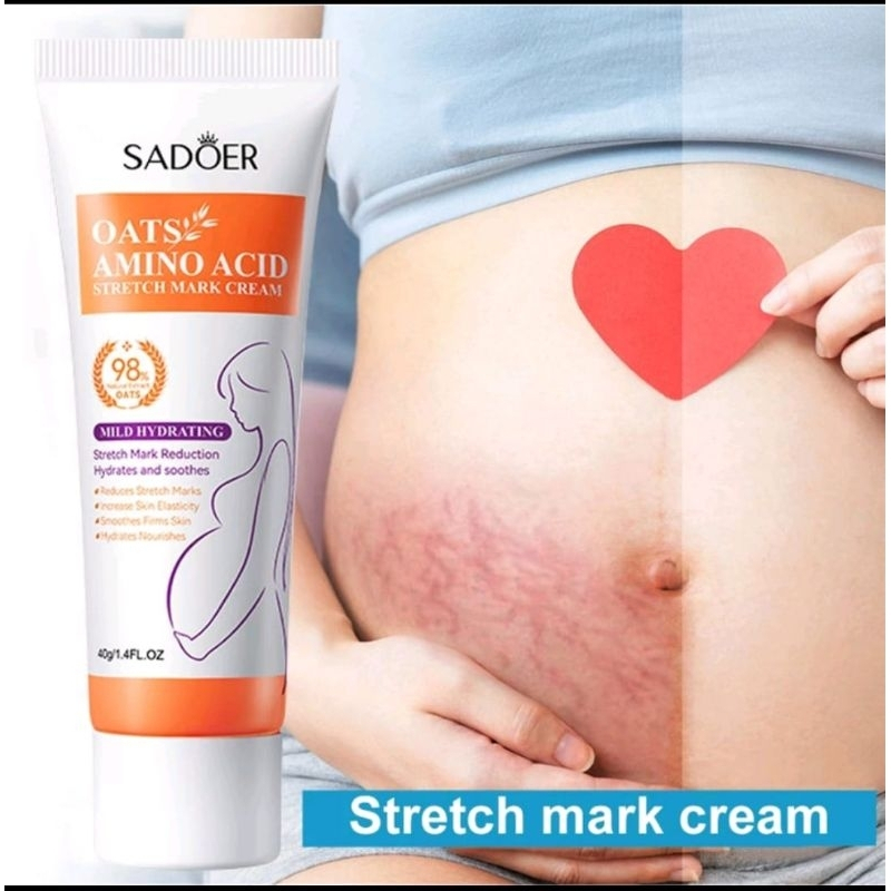 COD Stretch Mark Cream penghilang strechmark ampuh permanen Stretch Mark Dan Obesity Mark 40g Krim P