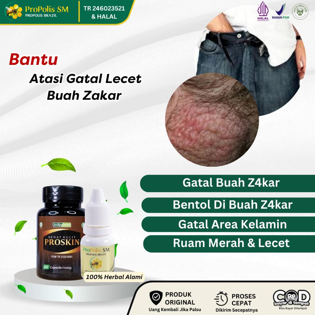 Obat Gatal Buah Zakar, Obat Gatal Selangkangan, Obat Bentol Di Buah Zakar, Obat Kemaluan Pria Gatal,