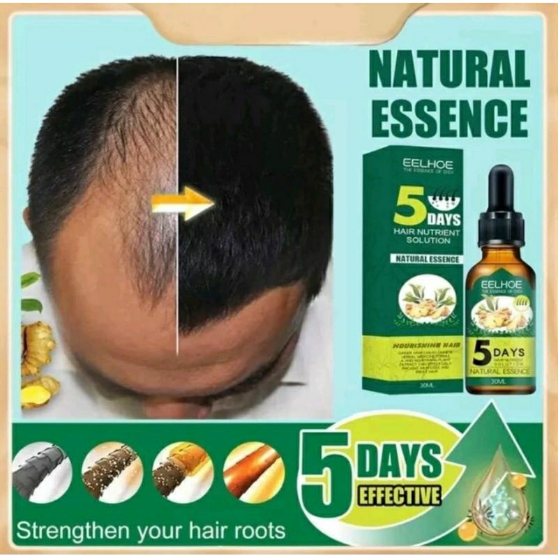 Eelhoe Hair Nutrient Solution Natural Essence Serum Penumbuh Rambut