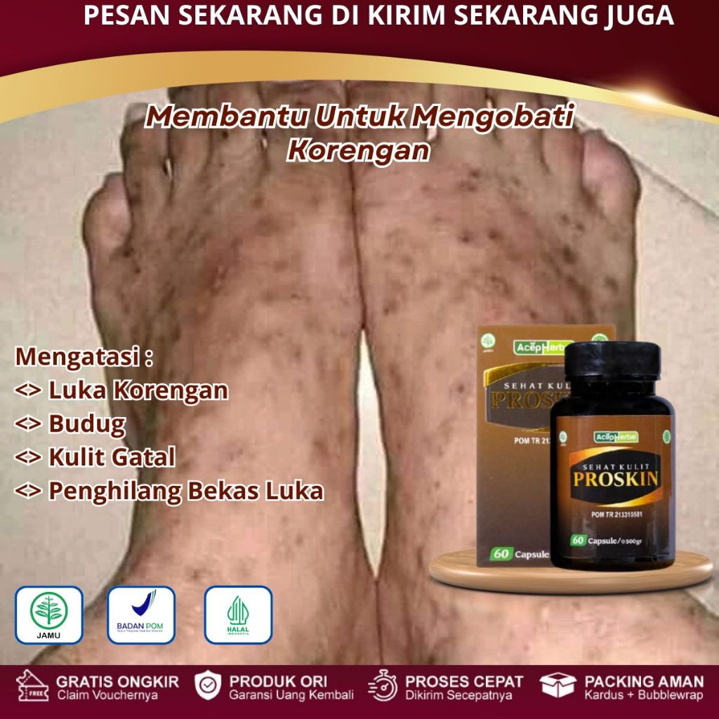 Obat Koreng Di Kaki, Obat Penghilang Koreng, Obat Koreng Bernanah, Obat Bekas Luka Koreng Hitam, Men