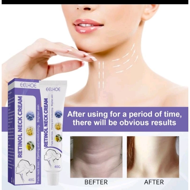 eelhoe retinol neck cream 40gr pemutih kulit leher