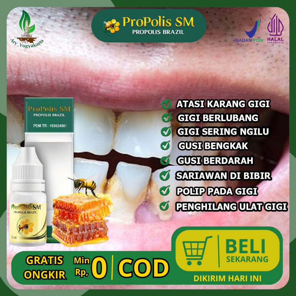 Obat Herbal Karang Gigi Ulat Gigi Anti Karang Gigi Membandel Karang Gigi Dan Plak Obat Kumur Peronto