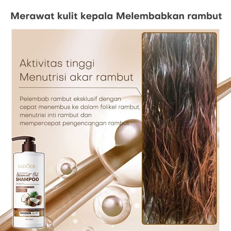 Shampo anti ketombe Penghilang Ketombe Berkerak Dan Gatal obat ketombe kerak kulit kepala obat ketom