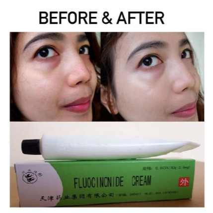 ❤LOLA❤ FLUOCINONIDE CREAM | Salep Walet Original Fluocinonide Cream Penghilang Flek Hitam