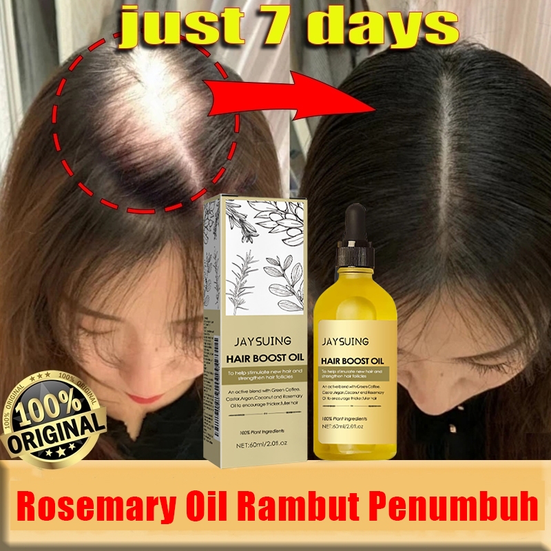 Rosemary Rambut Penumbuh Oil 60ml Penumbuh Rambut Cepat Serum Rambut Penumbuh Rambut Botak Perawatan