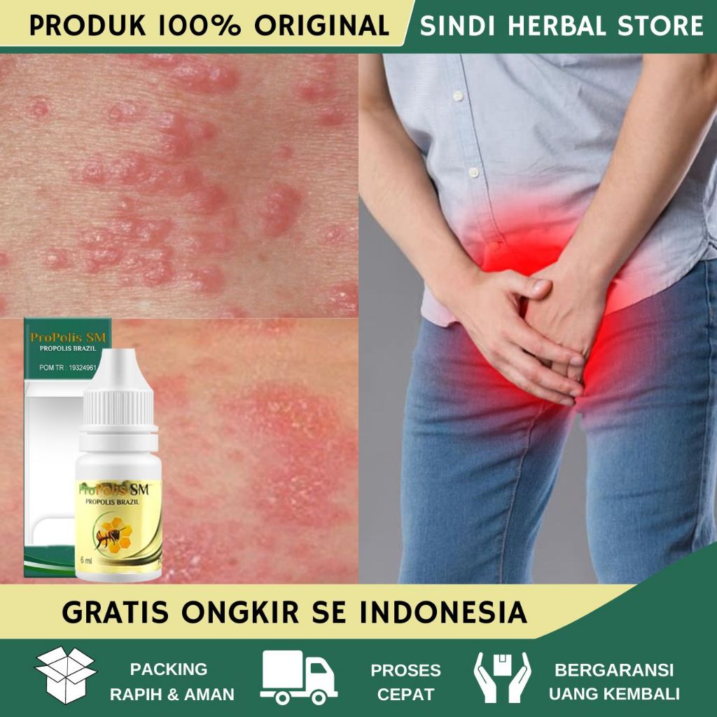 Obat Gatal Selangkangan, Obat Masalah Kulit Gatal Di Selangkangan Pria Wanita, Obat Selangkangan Hit