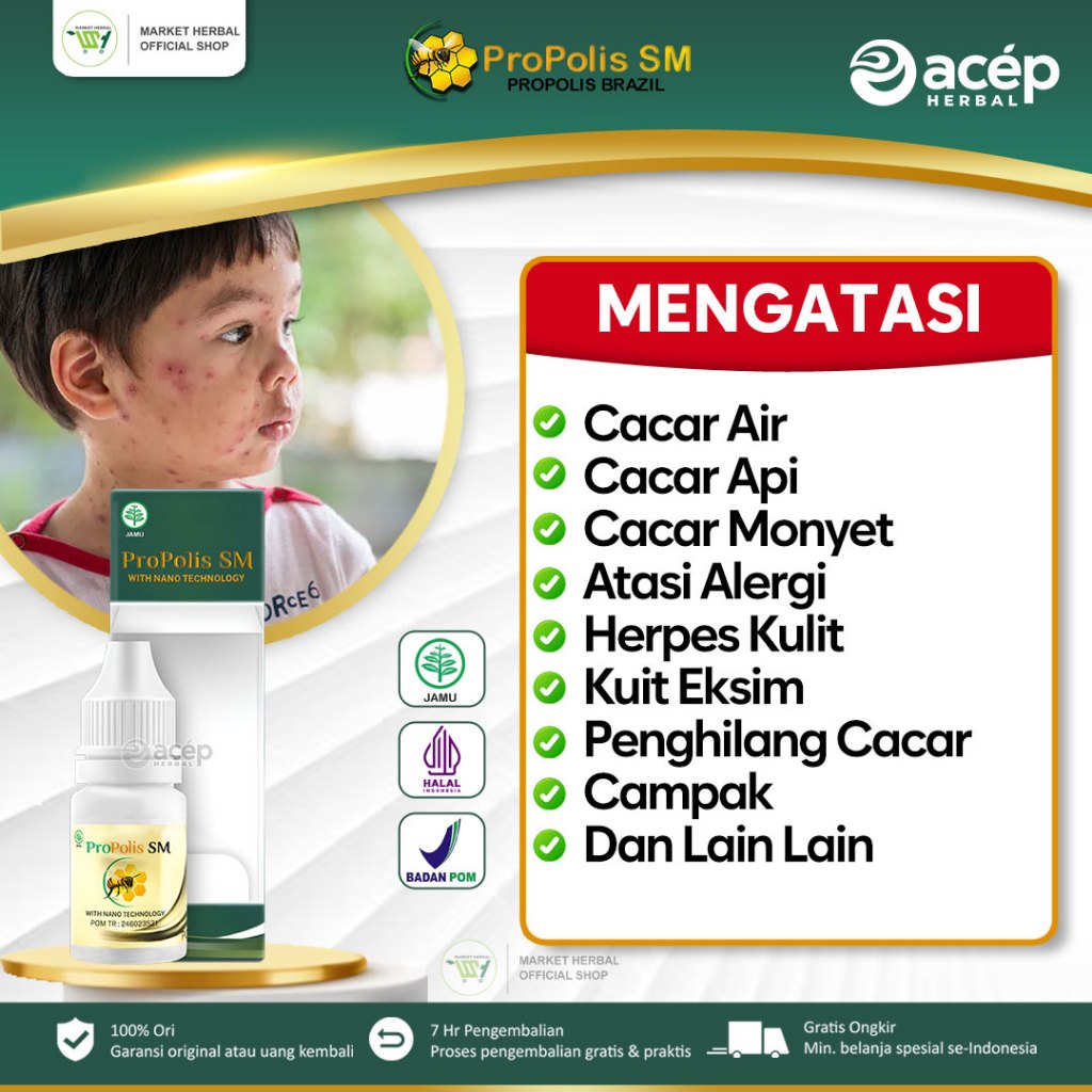 Market Herbal - Obat Cacar Air, Obat Cacar Api, Obat Penghilang Bekas Cacar, Obat Herpes Kulit, Obat