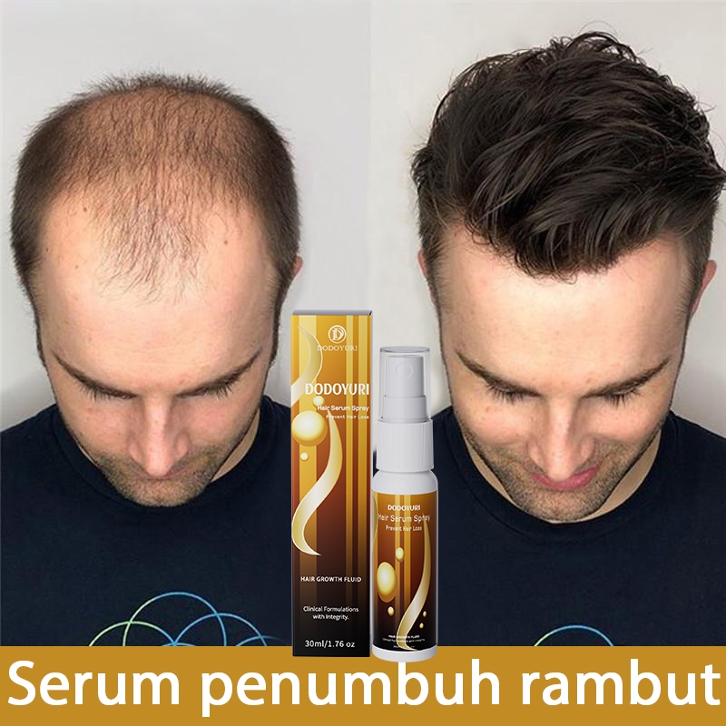 Obat penumbuh rambut hair tonic rambut rontok serum rambut rontok penumbuh rambut cepat 30ml penumbu