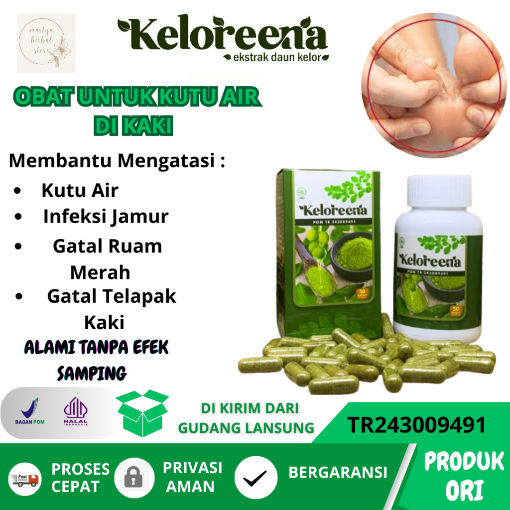 Obat Herbal Penghilang Kutu Air Di Kaki Dan Tangan Obat Kuman Air Obat Jamur Kutu Air Obat Gatal Kul