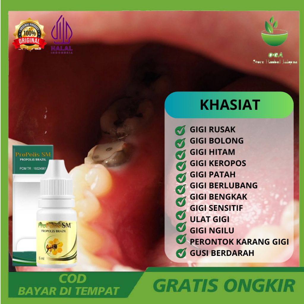 PROPOLIS Asli Obat Sakit Gigi Rusak, Obat Gigi Bolong Berlubang, Obat Ulat Gigi, Obat Gigi Hitam Ker