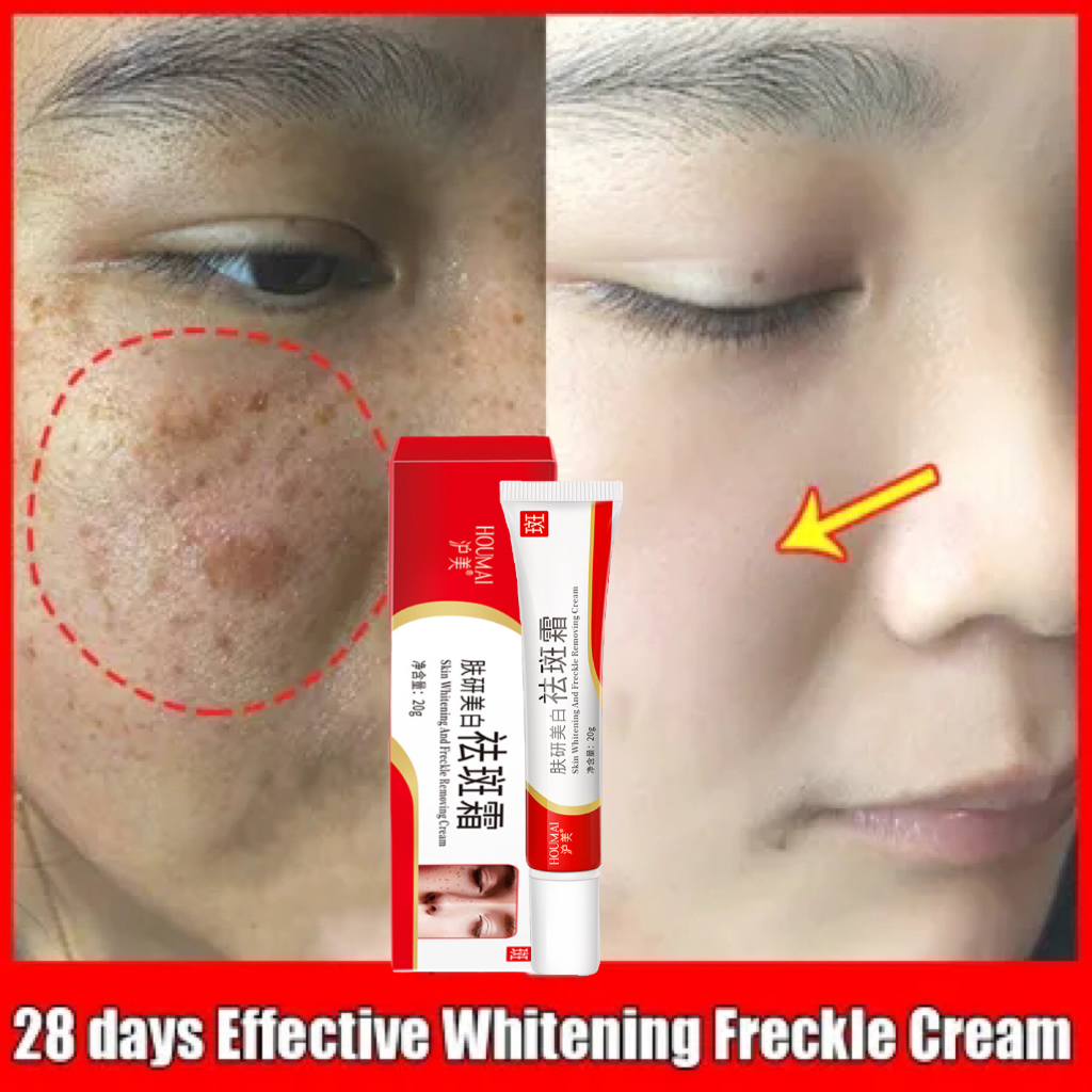Dark Spots Penghilang Flek Hitam Membandel Whitening Freckle Cream Remove Dark Spots Anti Penuaan Di