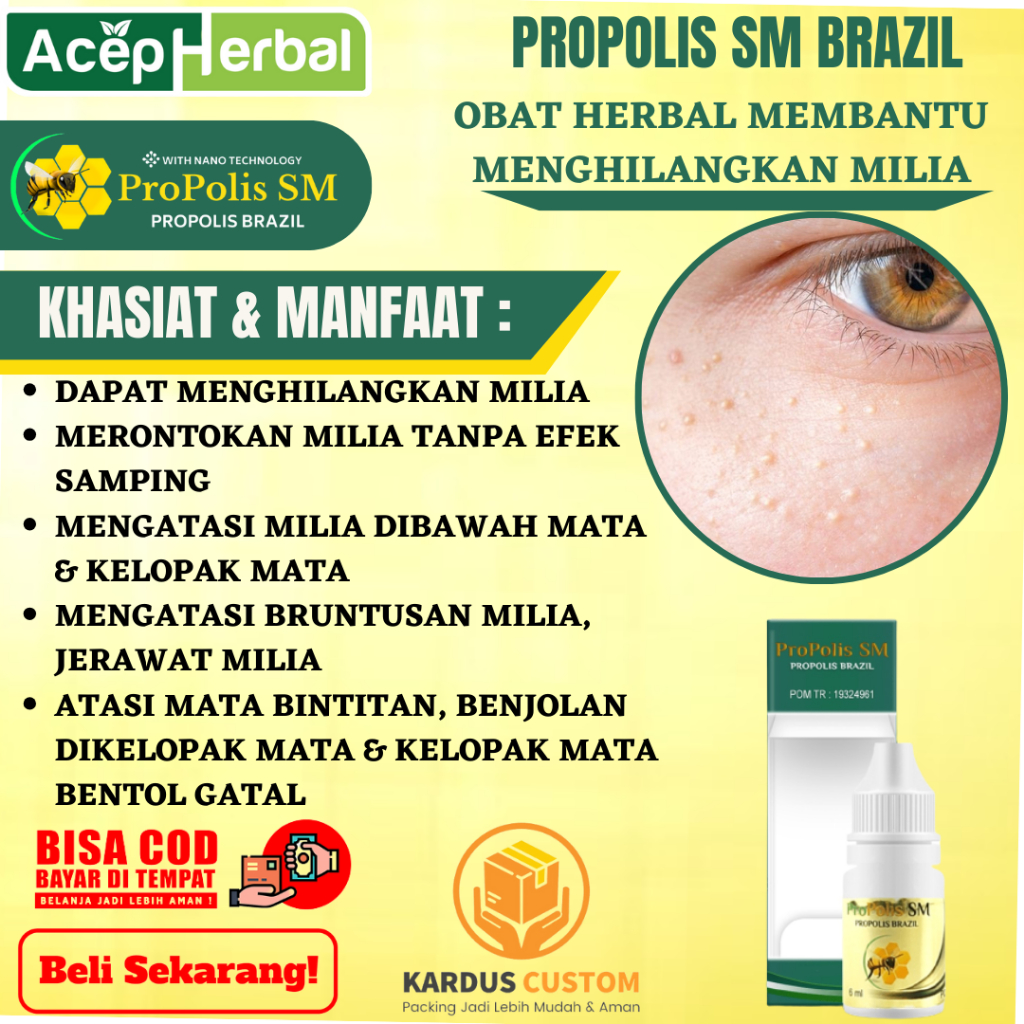 Obat Menghilangkan Milia, Perontok Milia Alami Tanpa Efek Samping, Milia Di Bawah Mata, Kelopak Mata