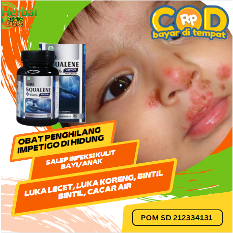 Obat Penghilang impetigo di hidung, Salep infeksi kulit bayi/Anak, luka lecet, luka koreng, bintil b