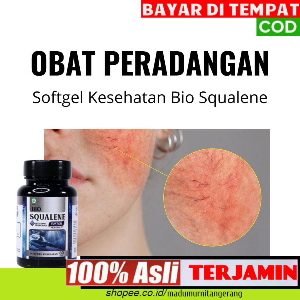 Obat Peradangan Seperti Radang Kulit - Sendi - Tenggorokan - Telinga - Mata & Peradangan Lainya -  B