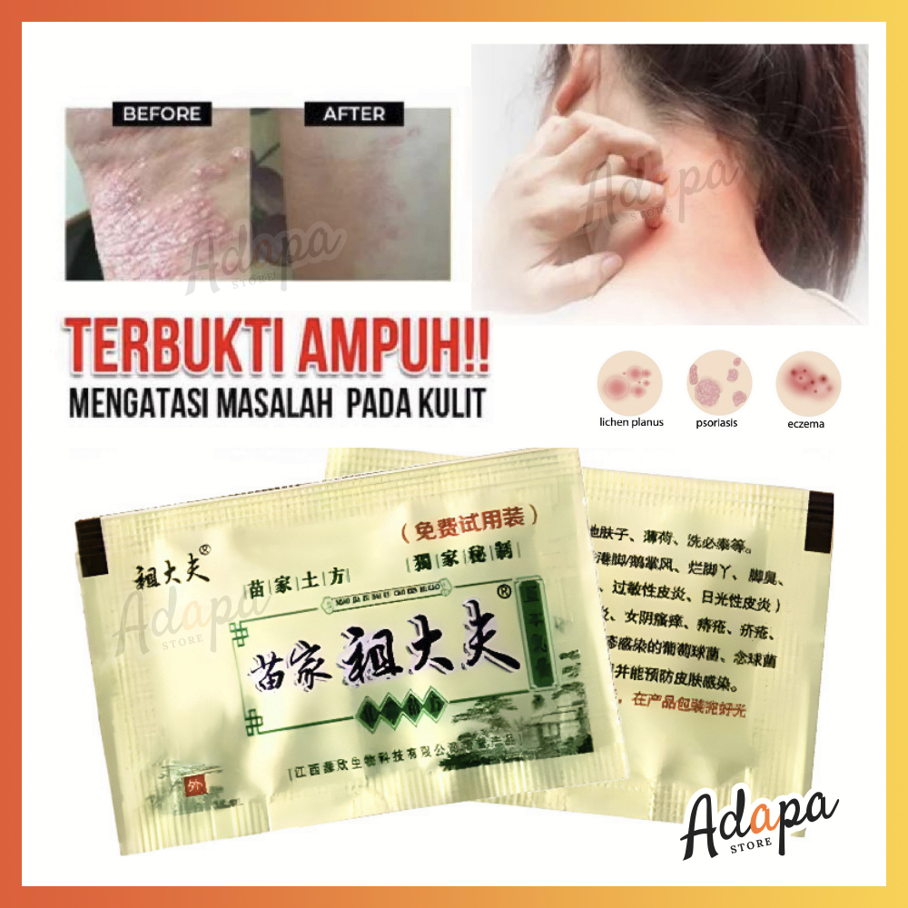 ❤ ADAPA ❤ Salep Sachet Zudaifu Original 2gr / Salep Saset Zu Dai Fu Chy Gao Obat Gatal Kulit Selangk