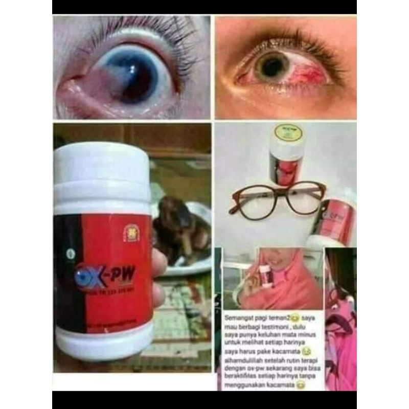 Mata Obat Katarak 60 Kapsul