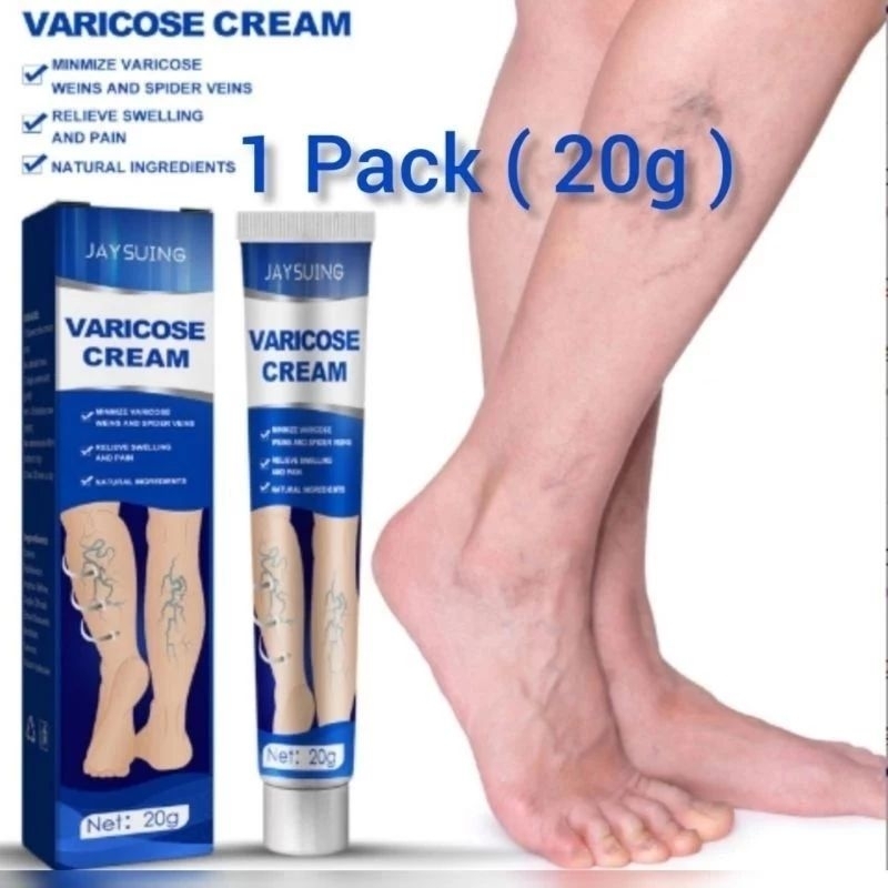 ( 100% Asli )  Krim Varises, 20g. Krim Kaki Menenangkan Varises Vena Alami Pengobatan Varises & Spid