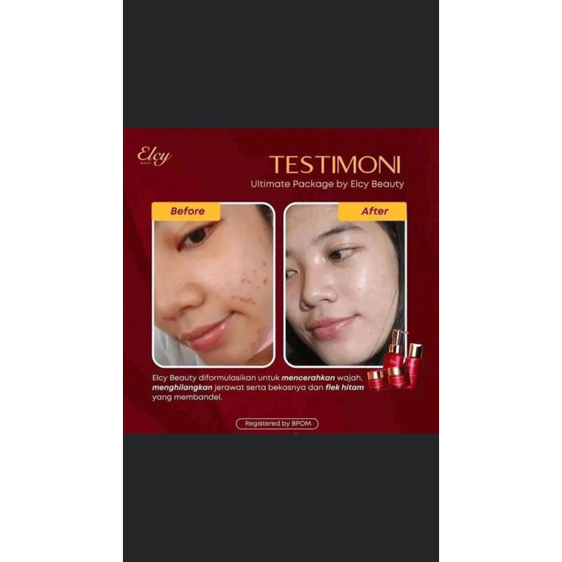 Cream LC beauty Original / Serum / Jelly Pelicin