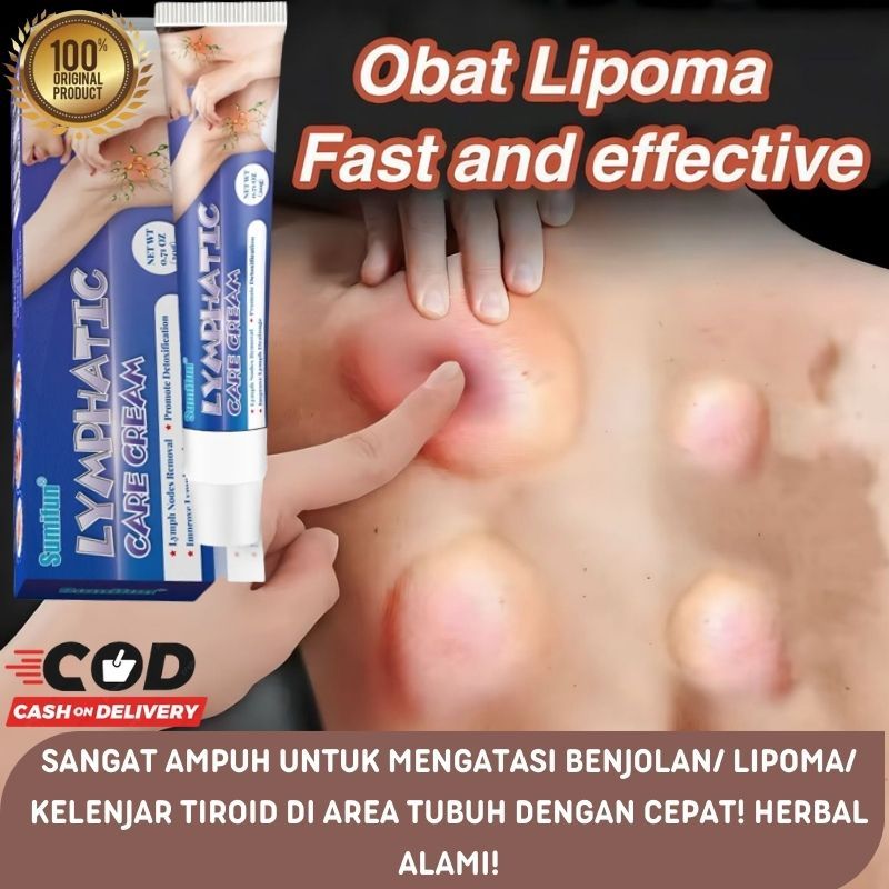 7 days lymphatic cream krim pengempis benjolan lipoma