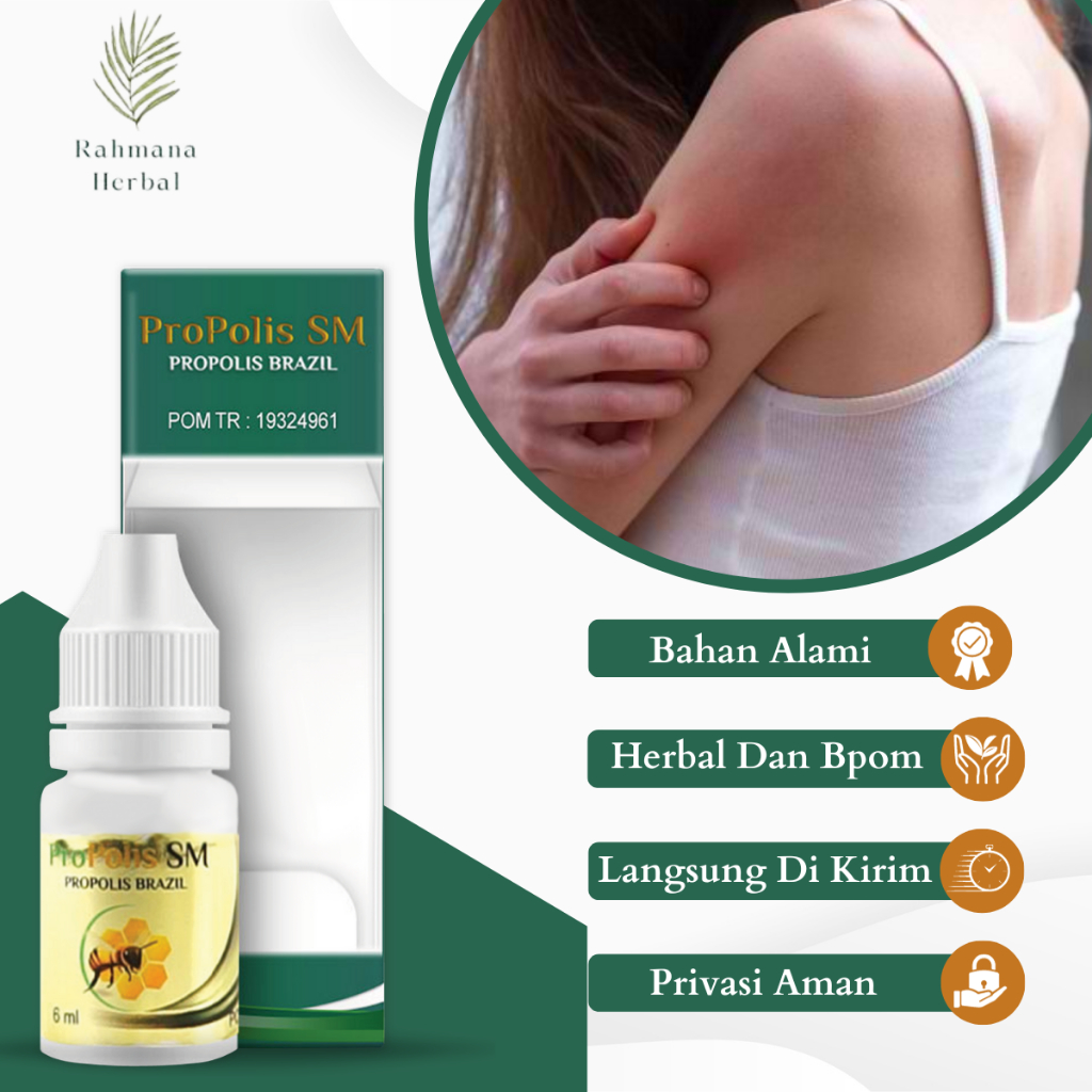 Obat Gatal Seluruh Badan, Obat Badan Gatal, Obat Ruam Merah, Obat Gatal Ruam Merah, Obat Kulit elepu