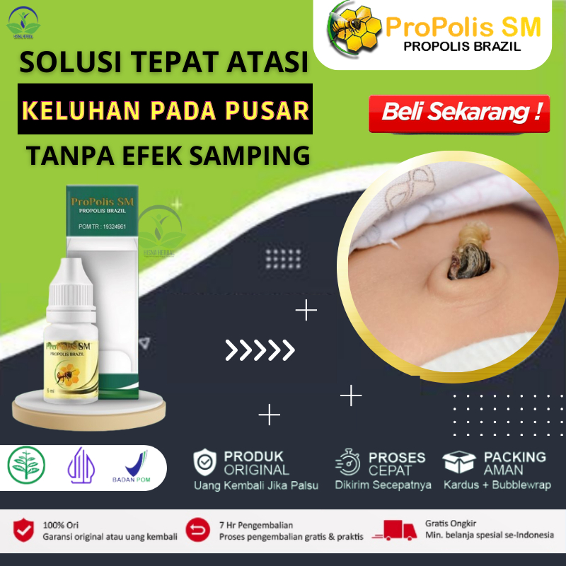 Obat Granuloma Umbilikalis, Bau Puser Bayi, Pusar Terasa Sakit, Pusar Gatal, Pusar Bau, Pusar Bernan
