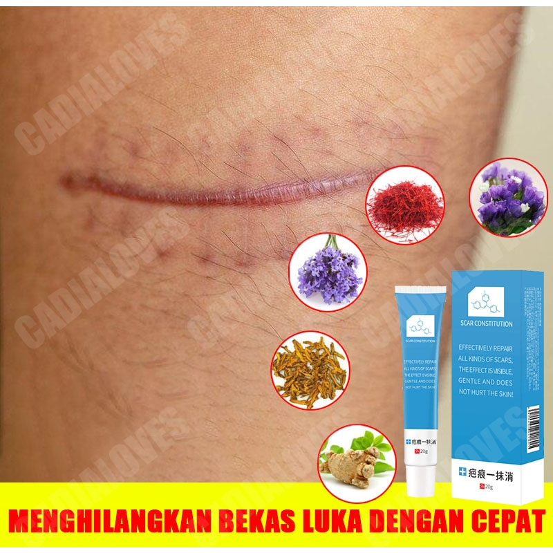 penghilang bekas luka lama/Penghilang Bekas Luka/penghilang bekas luka koreng hitam/salep penghilang