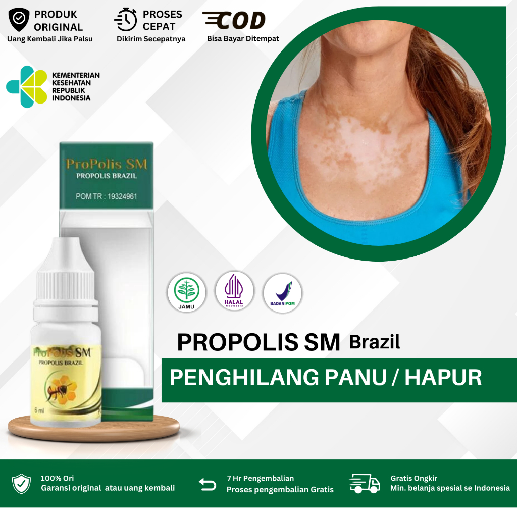 Obat Penghilang Panu, Obat Hapuran Kulit, Obat Penghilang Panu, Obat Hapur Di Punggung, Obat Panu Se