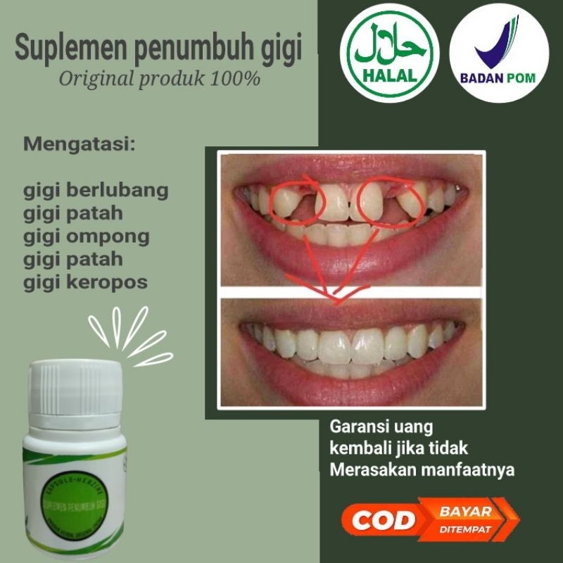 SUPLEMEN PENUMBUH GIGI BOLONG,PATAH,BERLUBANGAMPUH ORIGINAL 100%
