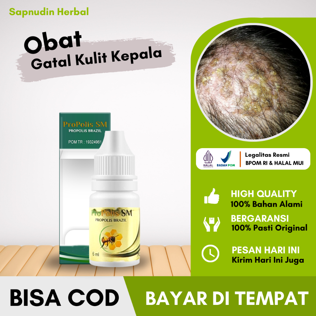 Obat Gatal Kulit Kepala, Obat Gatal kulit Tetes, Obat Gatal Kulit Berair, Obat Gatal kulit Anak, Oba