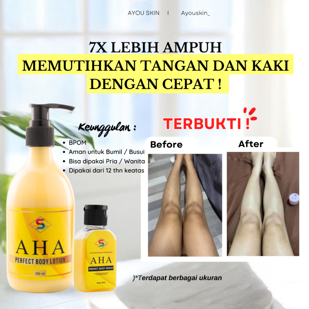 HandBody Body Lotion BPOM Pemutih Kaki Penghilang Bekas Luka, Pemutih Kaki Dan Tangan Permanen Bpom,