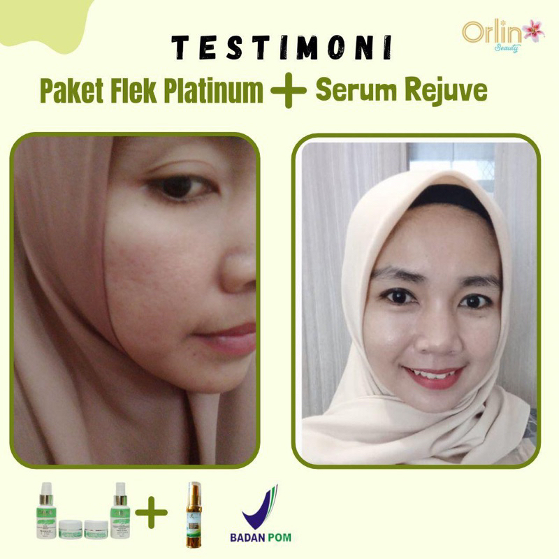 Orlin beauty Paket flek | Paket flek | orlin beauty | Ampuh menghilangkan flek | BPOM | skincare orl