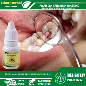 Obat Polip Pulpa Gigi, Obat Benjolan Di Gigi Berlubang,  Obat Penghilang Polip, Obat Daging Tumbuh D