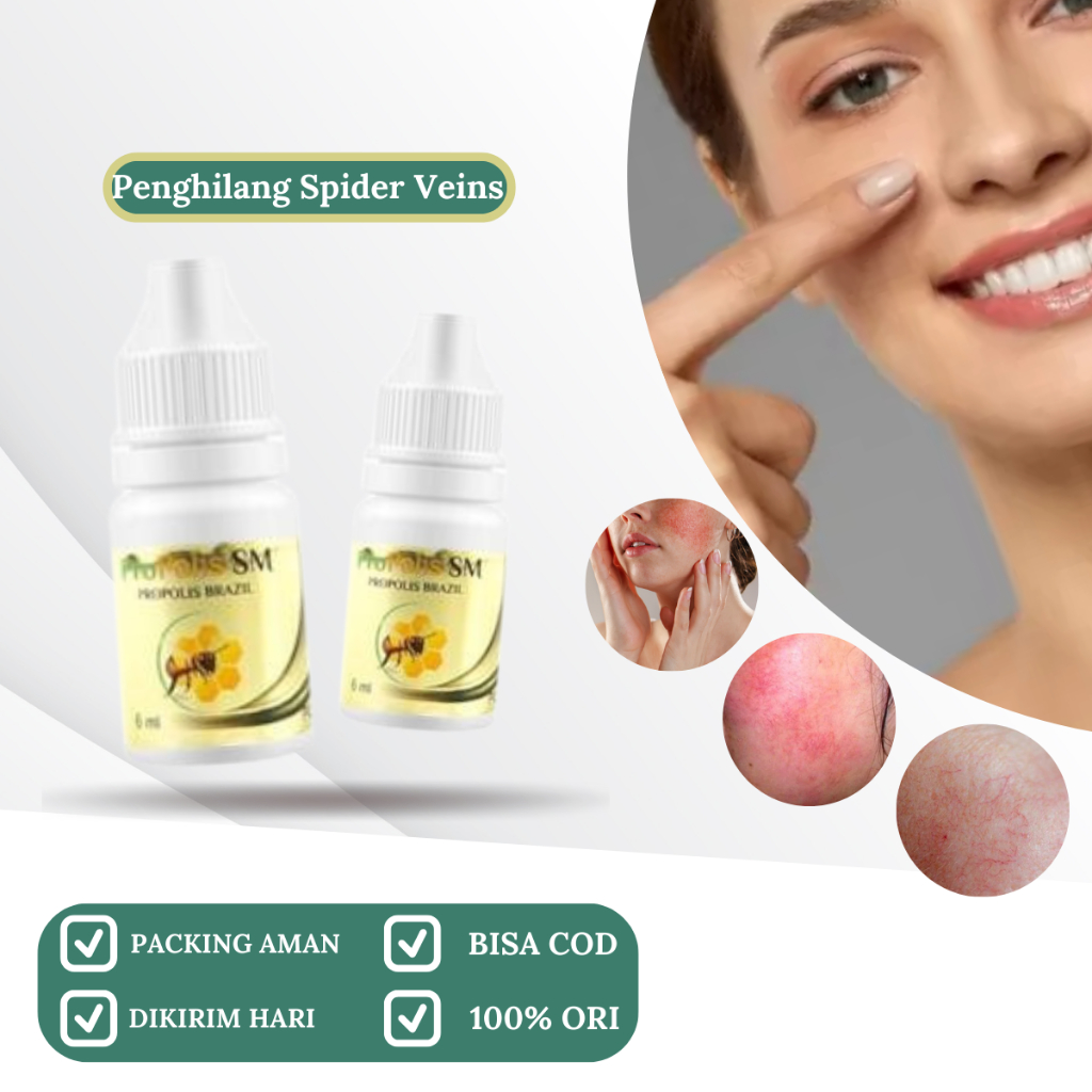 Obat Kulit tipis, mudah merah & spider veins, Obat Herbal Penghilang Urat Halus Di Wajah (spider vei