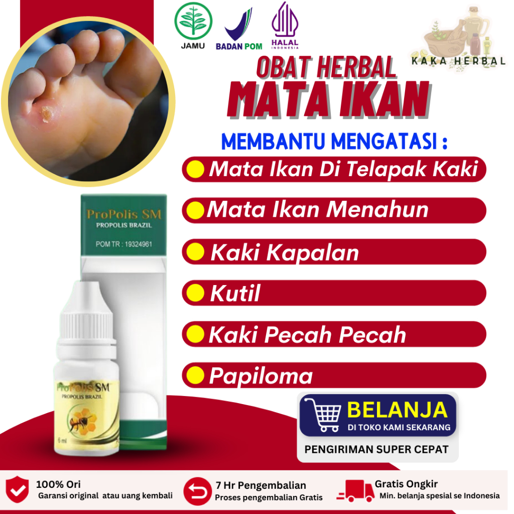 Kaka Herbal - Obat Mata Ikan Di Telapak Kaki, Obat Tetes Mata Ikan, Obat Penghancur Mata Ikan, Peron