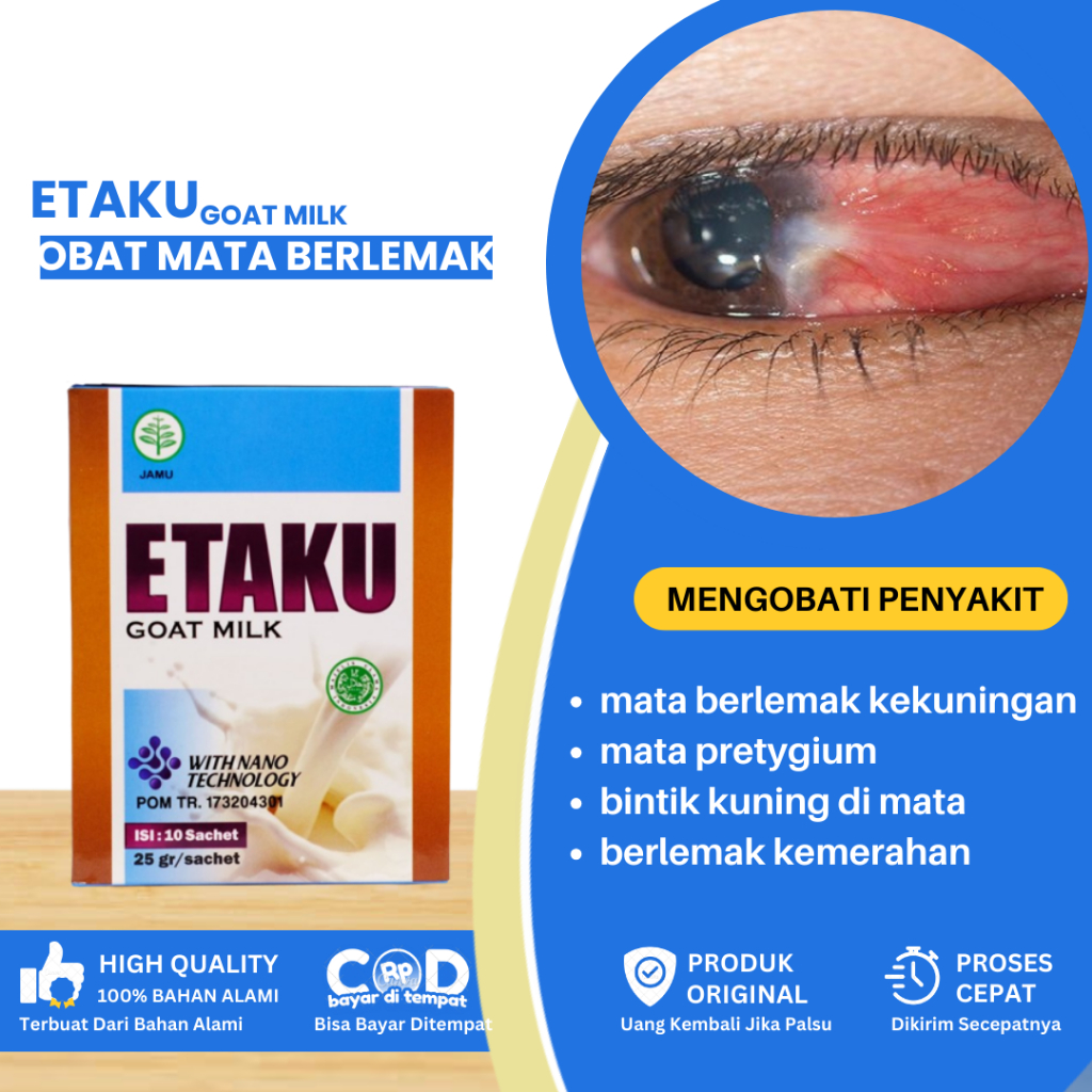 Obat Mata Berlemak Kekuningan, Obat Pterygium, Obat Matak Berlemak Kemerahan, Obat Penghilang Lamad 