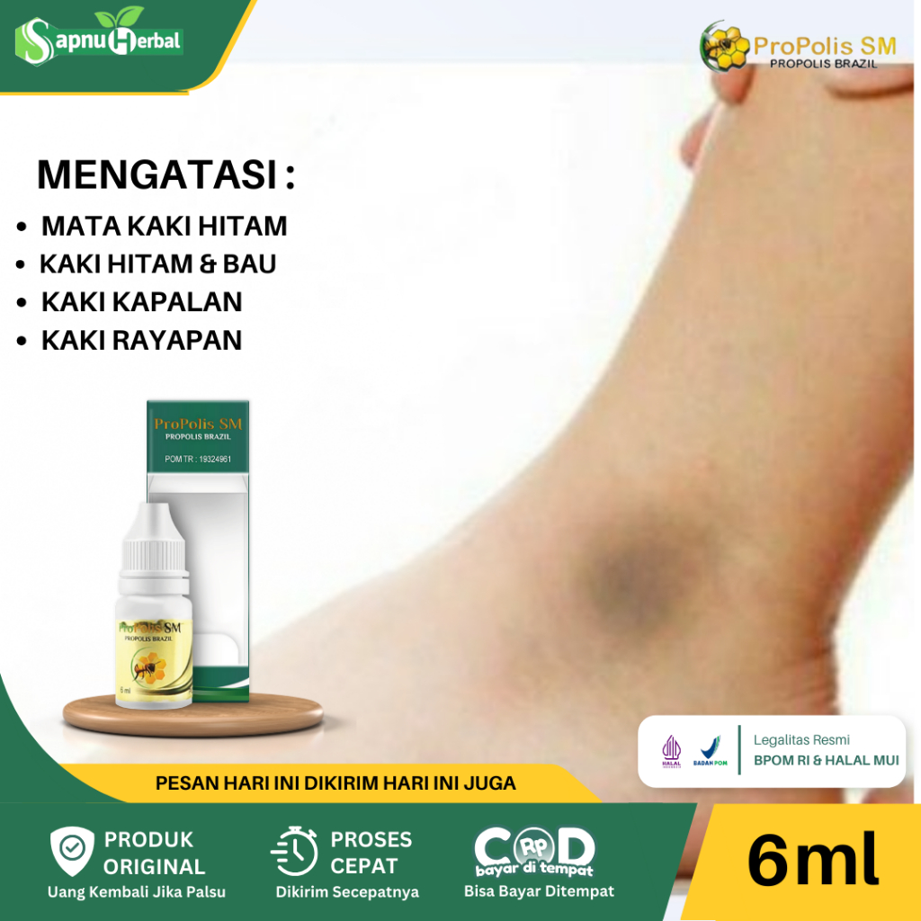 Obat Pemutih Mata Kaki Hitam Mata Kaki Hitam dan Kasar Kaki Kapalan Rorombeheun Tumit Kaki Pecah Pec